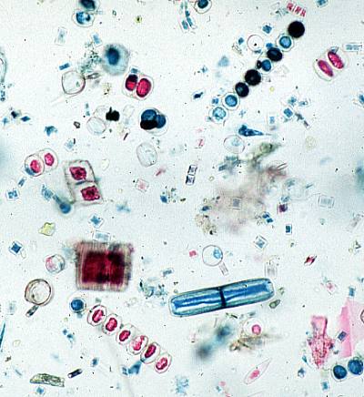 http://bio1903.nicerweb.com/Locked/media/lab/diversity/protista/img/Diatoms.jpg