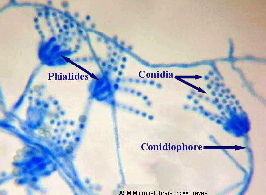 http://www.microbelibrary.org/microbelibrary/files/ccImages/Articleimages/treves/Penicillium_labeled.jpg
