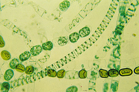 Spirogyra